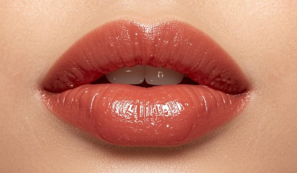 از بین بردن ورم لب بعد از تزریق ژل